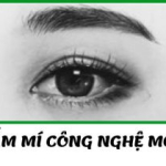 Bấm mí công nghệ mới – Khắc phục mọi khuyết điểm của đôi mắt