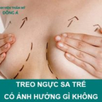 Treo ngực sa trễ có ảnh hưởng gì không. Những vấn đề bạn cần lưu ý!