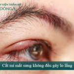 Cắt mí mắt sưng không – Nguyên nhân & Cách xử lý Hiệu Quả