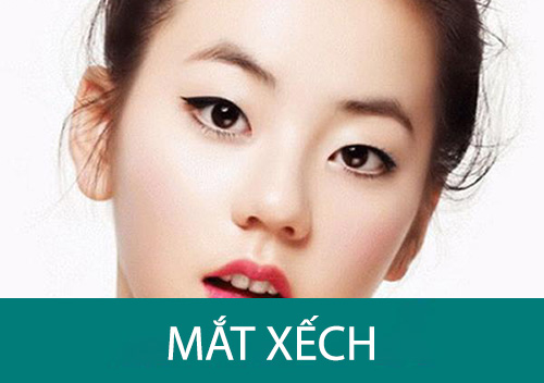 Mắt xếch là gì? Có khắc phục được mắt xếch?