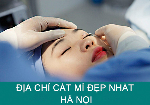 Top 7 địa chỉ cắt mí đẹp nhất Hà Nội phải tham khảo ngay