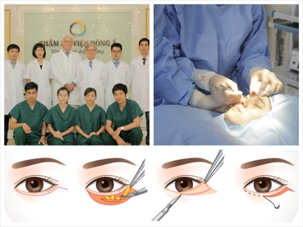 ĐỘI NGŨ CHUYÊN GIA BÁC SĨ HÀNG ĐẦU THẨM MỸ MẮT TẠI VIỆT NAM