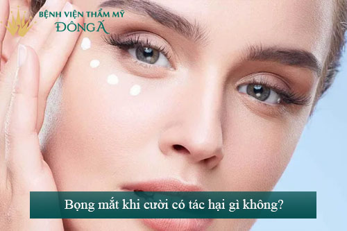 Bọng mắt cười là gì? Phẫu thuật bọng mắt cười giá bao nhiêu? 3