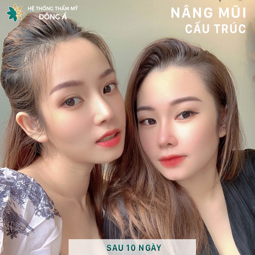 Thẩm mỹ viện Đông Á Đà Nẵng