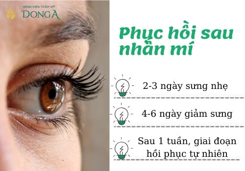 Nhấn mí sau 1 tuần đã đẹp tự nhiên chưa? 4 Yếu tố ảnh hưởng 2