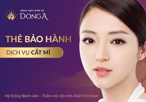 Cắt mí mắt ở đâu đẹp - AN TOÀN & UY TÍN nhất Hà Nội, TPHCM? 4