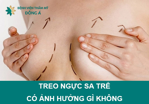 Treo ngực sa trễ có ảnh hưởng gì không. Những vấn đề bạn cần lưu ý!