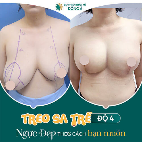 treo sa trễ bao nhiêu tiền